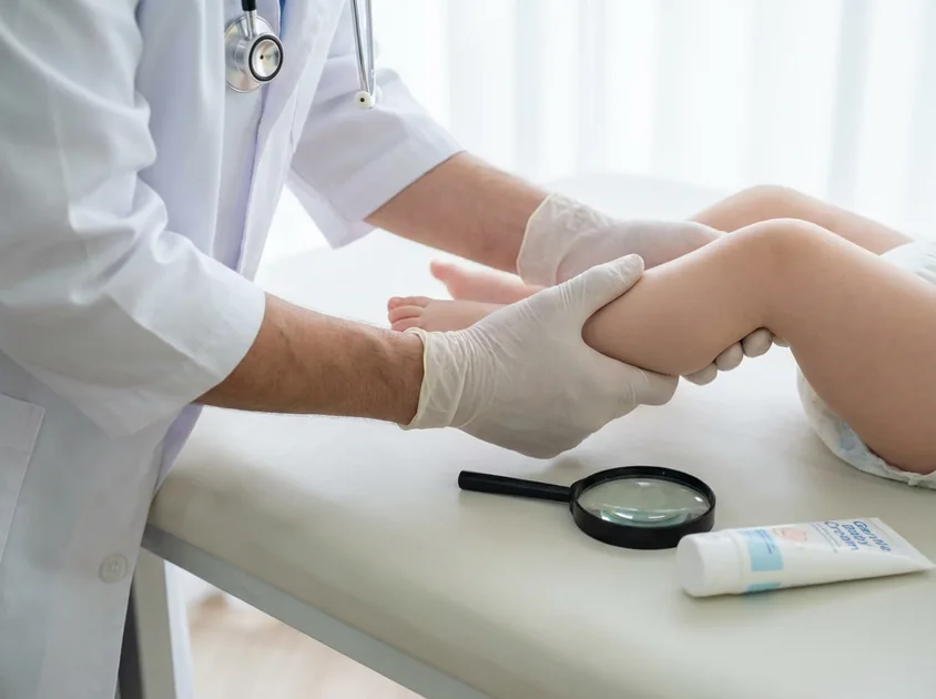 Körpə səpmələri və dermatit: Nə vaxt həkimə müraciət etməli?